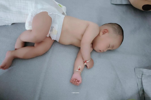 宁夏六个月宝宝眼睛散光